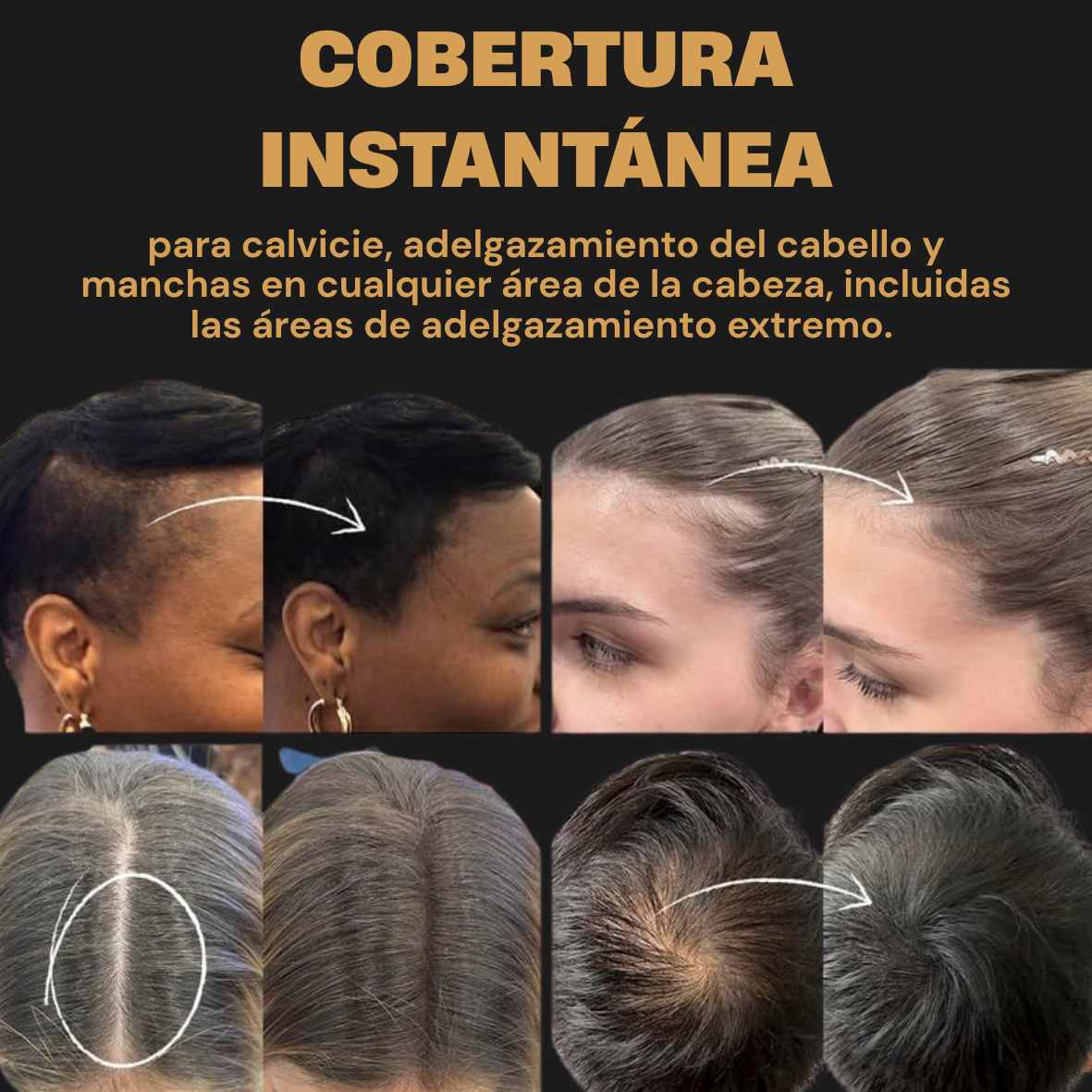 REGENESIS® RELLENO DE DENSIDAD CAPILAR Y TAPA CANAS